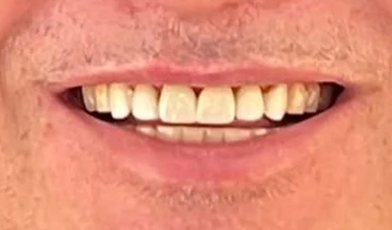 Sonrisa después del tratamiento
