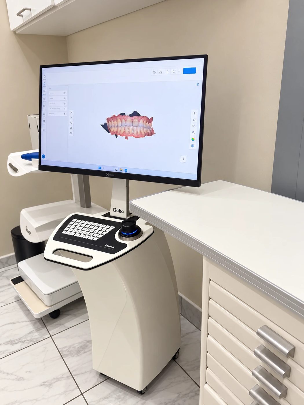 Escáner intraoral mostrando la sonrisa en 3D